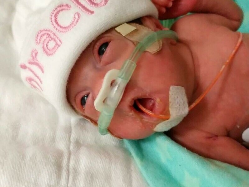 A tiny baby hooked up to multiple tubes, wearing a white hat that says 